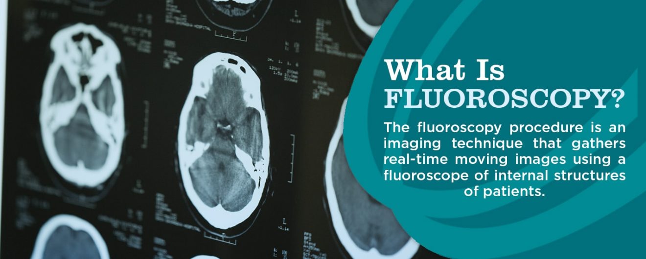 What Is Fluoroscopy and How to Prepare Envision Radiology