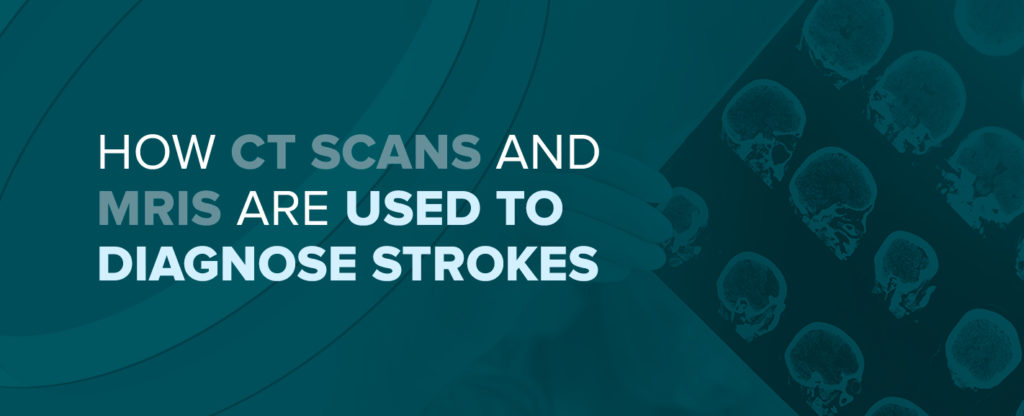 How Ct Scans And Mris Are Used To Diagnose Strokes Envision Radiology 6165
