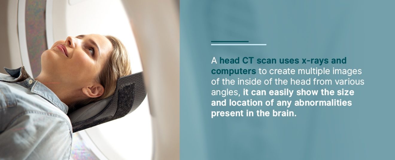 How Ct Scans And Mris Are Used To Diagnose Strokes Envision Radiology 6267