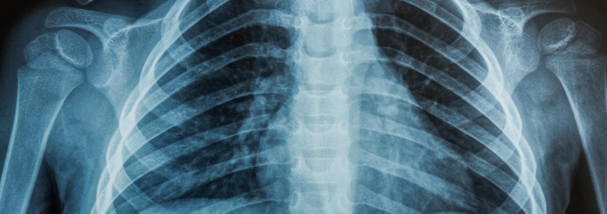 How to tell if you need an x-ray - Envision Radiology