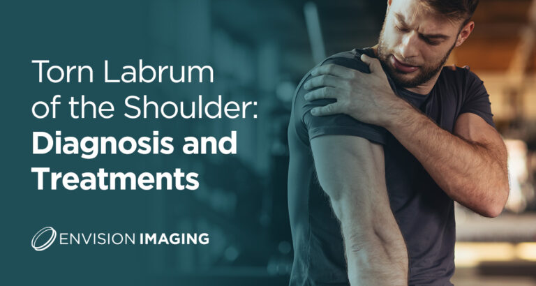 Torn Labrum Of The Shoulder Diagnosis And Treatments Envision Radiology