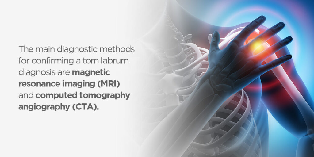 Torn Labrum Of The Shoulder Diagnosis And Treatments Envision Radiology