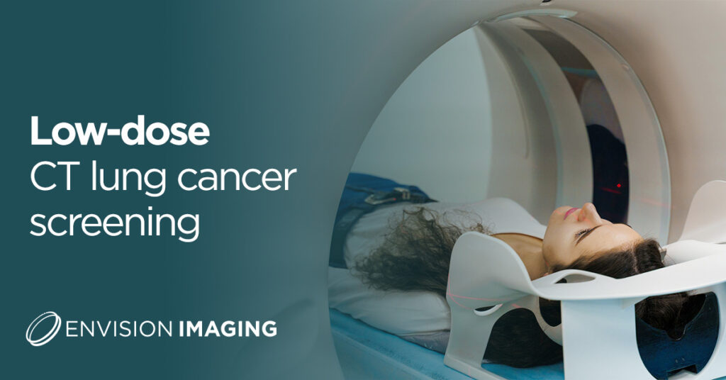 Low-dose CT lung cancer screening - Envision Radiology